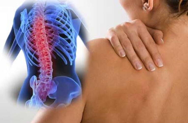 ក្នុងអំឡុងពេលនៃការរីករាលដាលនៃ osteochondrosis នៃឆ្អឹងខ្នង thoracic ការឈឺចាប់ dorsago កើតឡើង។